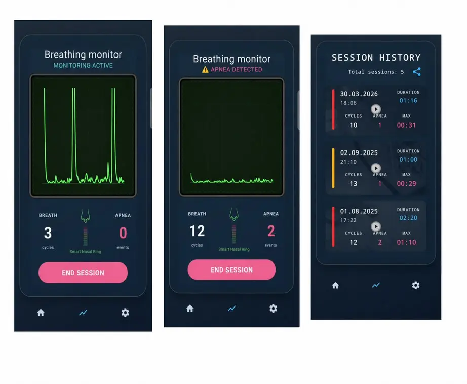 Smart Nasal Ring app — breathing monitor and session history